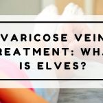 Varicose Vein Treatment