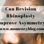 Can revision rhinoplasty improve asymmetry