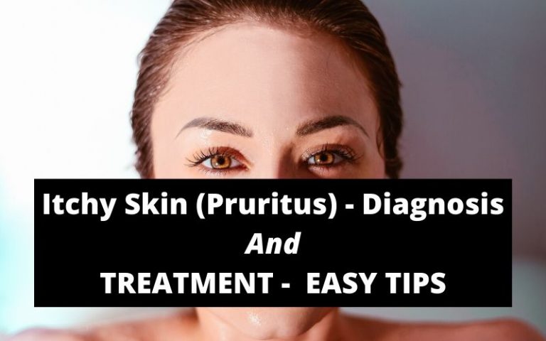 Itchy Skin (Pruritus) - Diagnosis And Treatment- Easy Tips