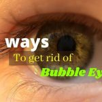 Eye bubbles