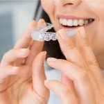 Invisalign treatment