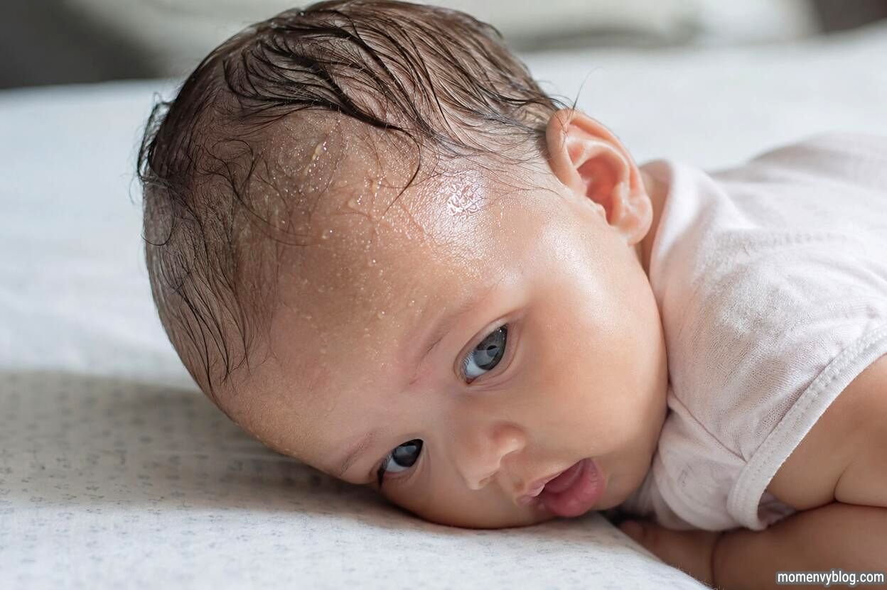 Baby lying on a bed with visible sweat on the forehead and scalp in a softly lit indoor setting.